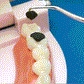 🦷Zestaw wykałaczek ze stali nierdzewnej
